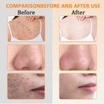 صابونة حمض الكوجيك وزيت جوز الهند وشجرة الشاي لتقليل التصبغات - 65 جم