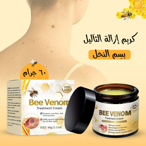 كريم إزالة الثآليل بسم النحل 60 جرام
