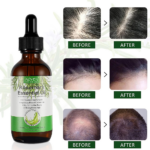 زيت أكليل الجبل لنمو الشعر - Growth Hair Rosemary Essential Oil - Image 3